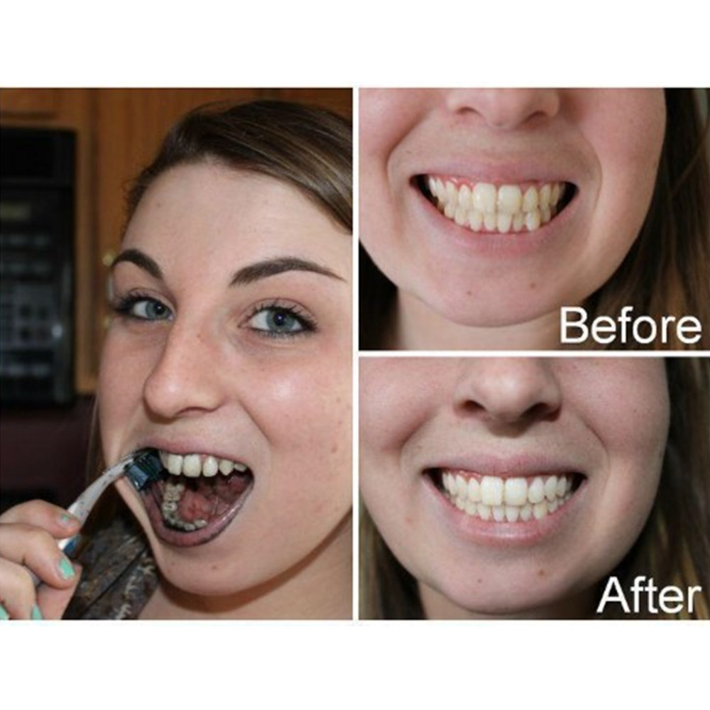 Bamboo Charcoal Teeth Tooth De - مراجعة Teeth Whitening Near Me وسعره