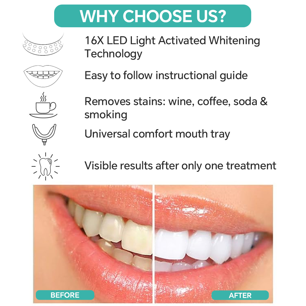 Teeth Whitening Accelerator Li - مراجعة Teeth Whitening With Blue Light وسعره
