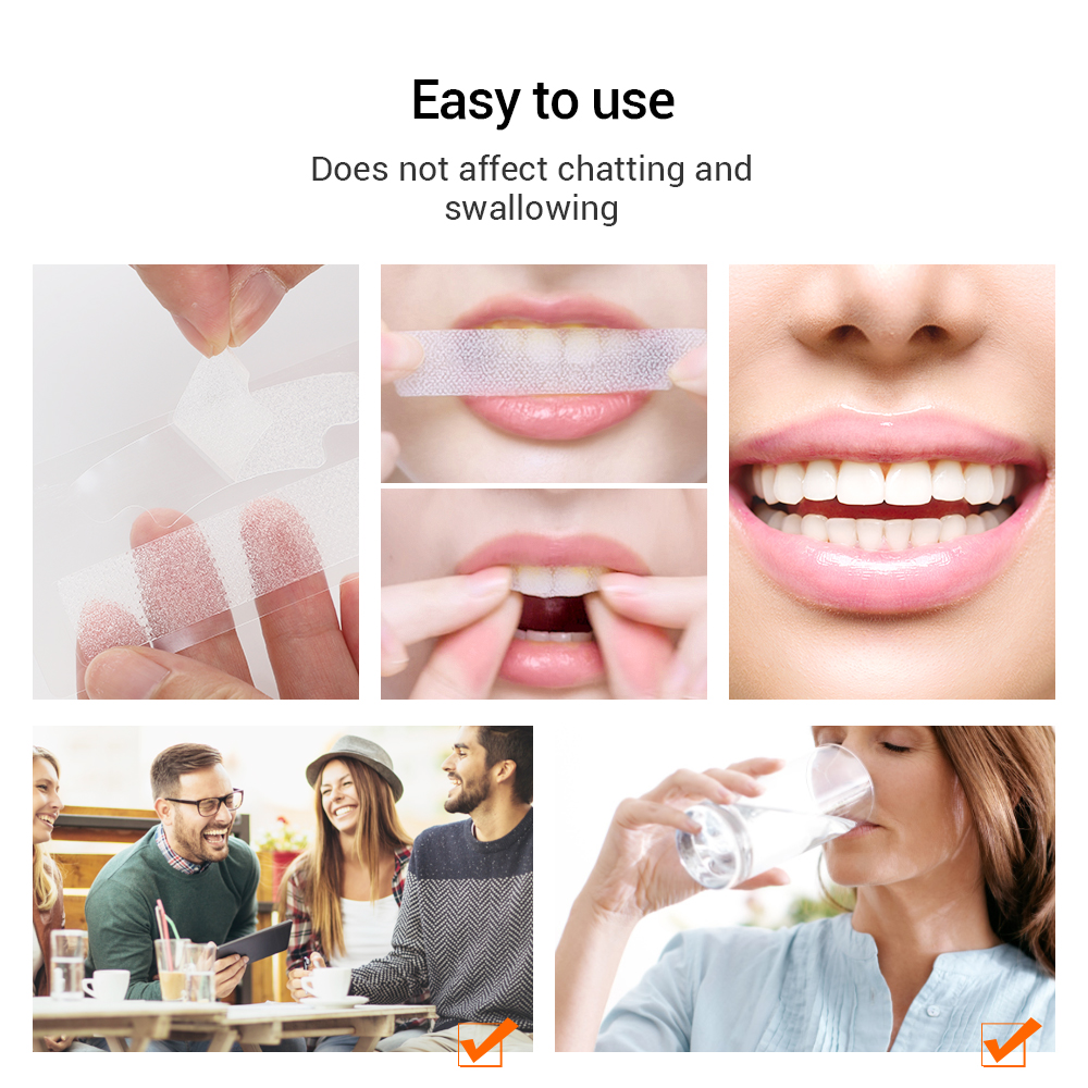 5D Teeth Whitening Strips Remo - مراجعة Teeth Whitening Bleaching Kit وسعره