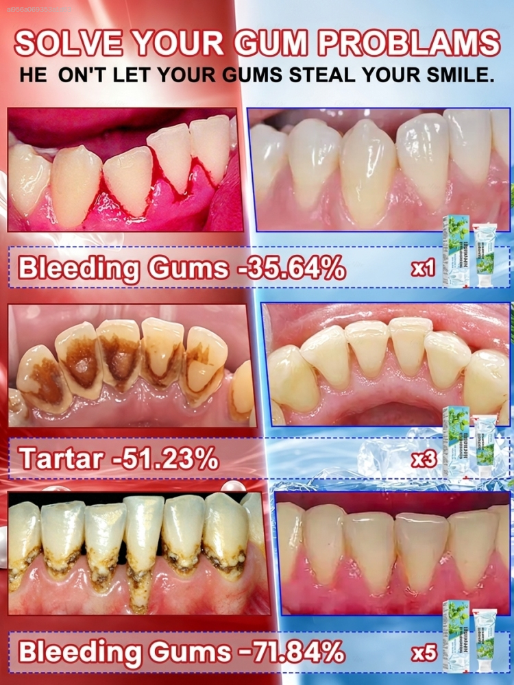 Intensive Probiotic Gum Treatm - مراجعة Teeth Whitening Paste وسعره