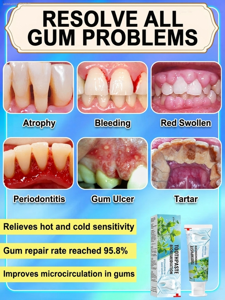 Intensive Probiotic Gum Treatm - مراجعة Teeth Whitening Paste وسعره