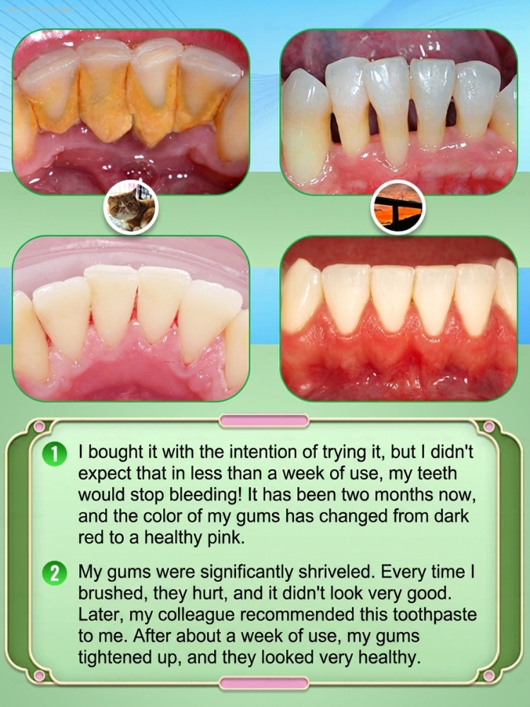 Intensive Probiotic Gum Treatm - مراجعة Teeth Whitening Paste وسعره