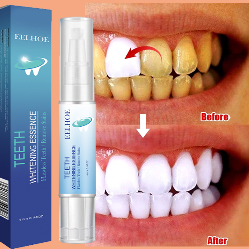 Teeth Whitening Pen Dental Ess - مراجعة Teeth Whitening Bleaching Kit وسعره