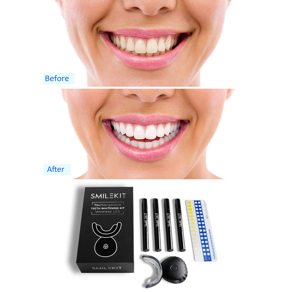 New Electric Teeth Whitening L - مراجعة Teeth Whitening Bleaching Kit وسعره