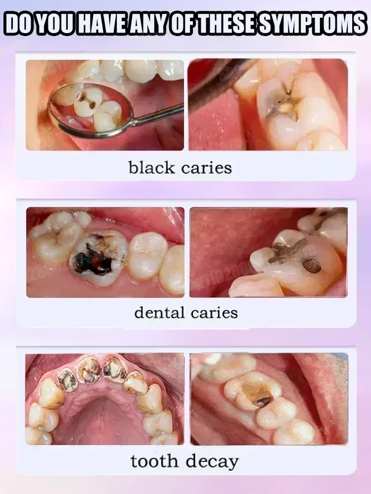 Teeth Cleaning Toothpaste Remo - مراجعة Teeth Whitening Toothpaste وسعره