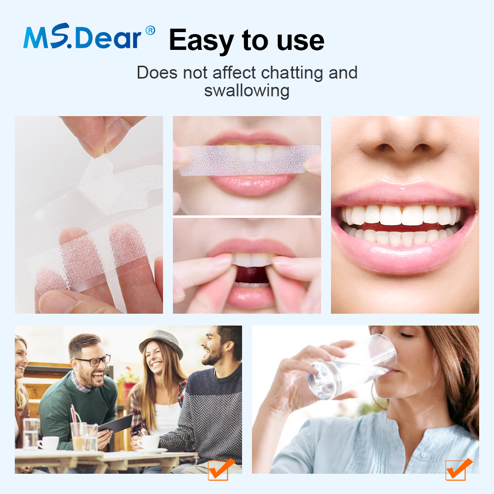 Teeth Whitening Strips Cleansi - مراجعة Teeth Whitening Paste وسعره